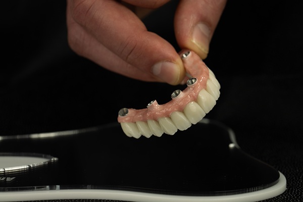 All-on-4 Can Replace Multiple Teeth