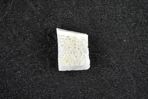 What is the Purpose of a Bone Graft Procedure?