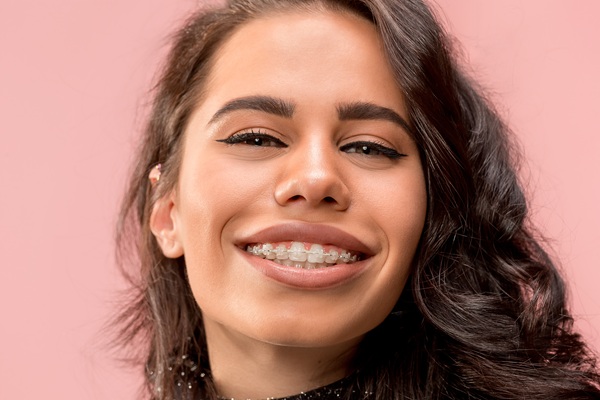 How Long Does Treatment with Clear Braces Normally Take?