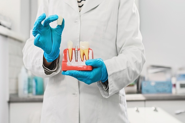 What to Do After Damaging a Dental Crown