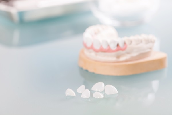 Adjusting to Your New Life With Dental Veneers