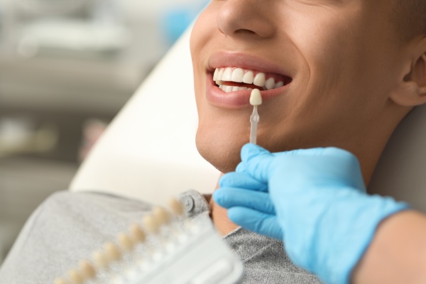 The Process of Getting Dental Veneers: What to Expect