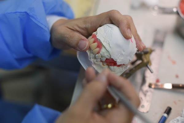 Denture Repair Tucson, AZ
