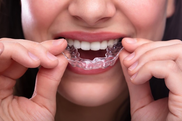 Invisalign Tucson, AZ