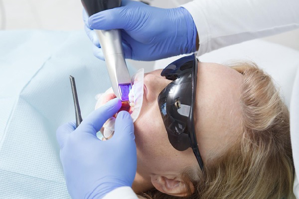 The Ultimate Guide to Understanding the iTero Intraoral Scanner