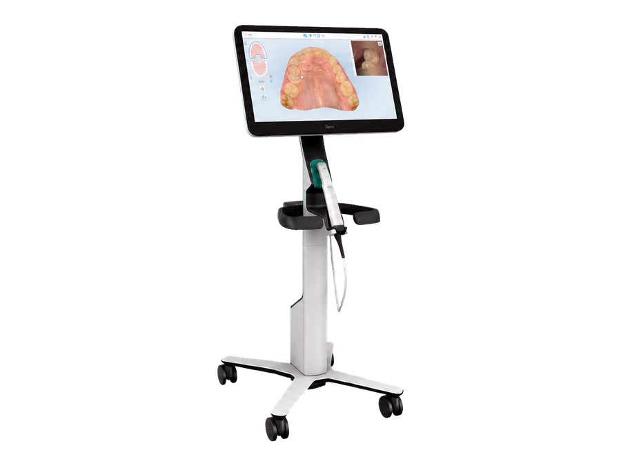 The iTero Lumina scanner on its cart, with the scanning wand in its holder and a 3D digital impression of the upper teeth on screen
