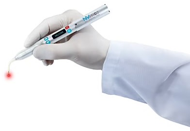 A gloved hand holding the NV PRO3 soft-tissue laser, showing that it is about the size of a pen