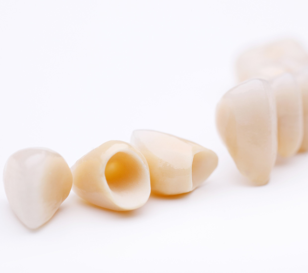 Tucson Dental Crowns and Dental Bridges