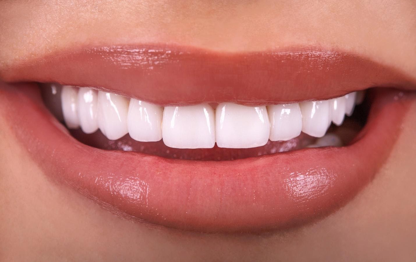The Top Concern Patients Have About Dental Veneers