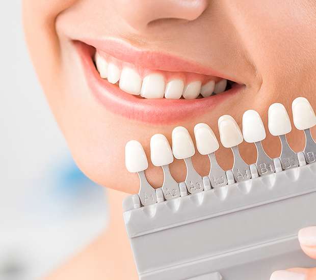 Tucson Dental Veneers and Dental Laminates