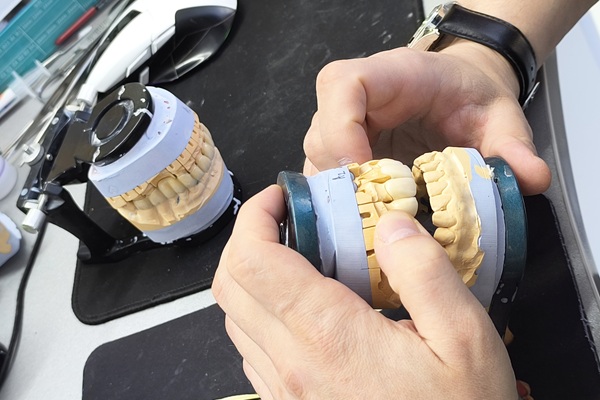 Full Mouth Reconstruction For Tooth Restoration