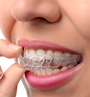 Clear Aligners - Almost Invisible Braces Tucson, AZ