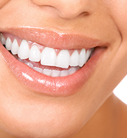 Teeth Whitening Services Tucson, AZ