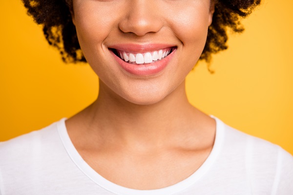 Veneers To Fix Tooth Imperfections